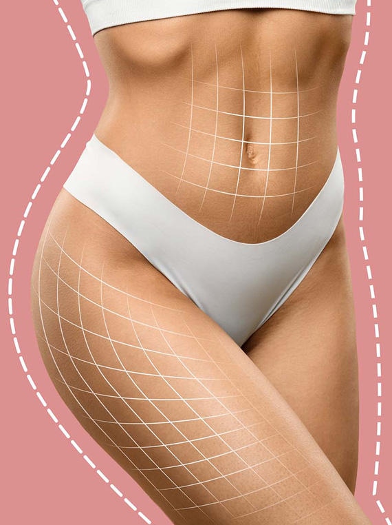 Body Contouring
