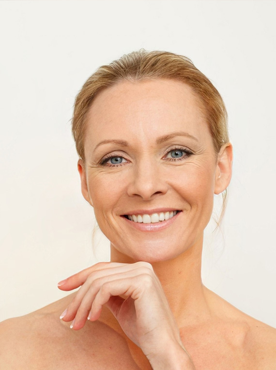 FINE LINES & WRINKLES